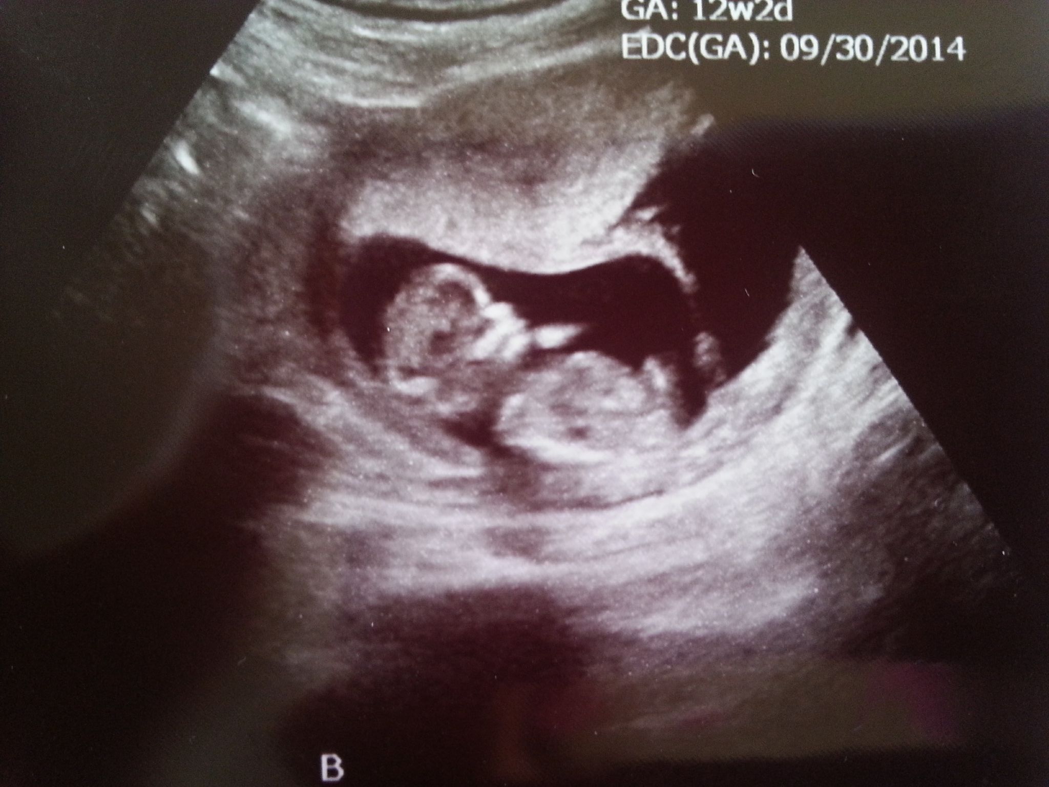 Name:  babyB2_12wks.jpg
Views: 988
Size:  307.9 KB