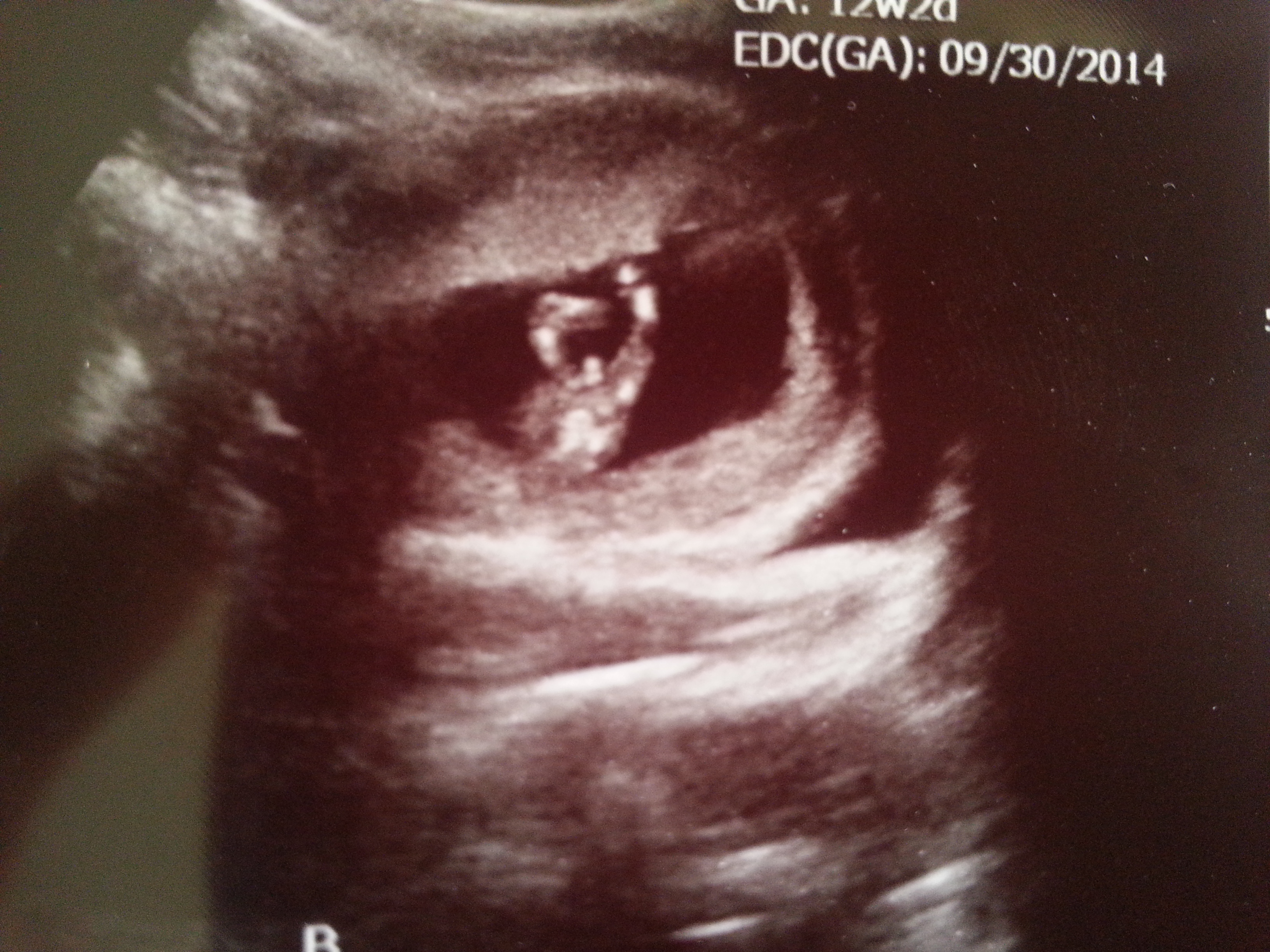 Name:  babyb_12wks.jpg
Views: 801
Size:  2.58 MB