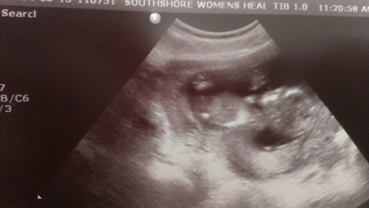 Name:  babywaving.jpg
Views: 265
Size:  79.7 KB