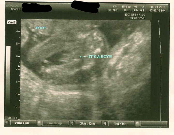 Name:  baby 1.jpg
Views: 234
Size:  208.2 KB