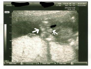 Name:  babyb.jpg
Views: 203
Size:  19.0 KB