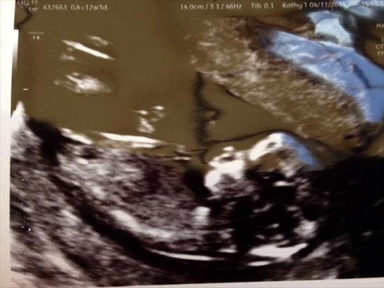 Name:  12weeks3d.jpg
Views: 529
Size:  28.9 KB