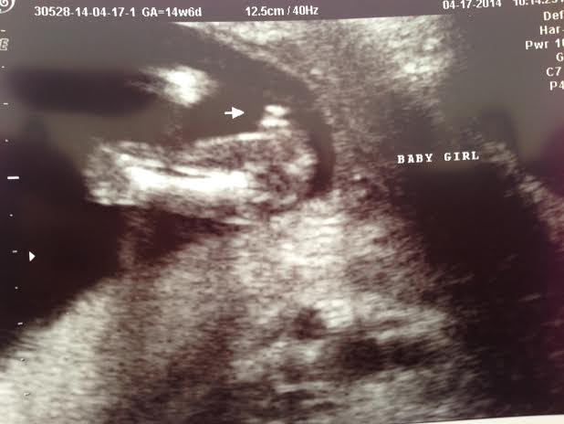 Name:  BABY GIRL!.jpg
Views: 213
Size:  42.4 KB