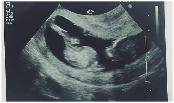 Name:  bby2.jpg
Views: 201
Size:  163.3 KB
