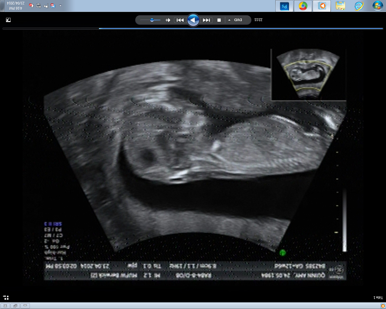Name:  12 weeks 6.jpg
Views: 3331
Size:  469.0 KB