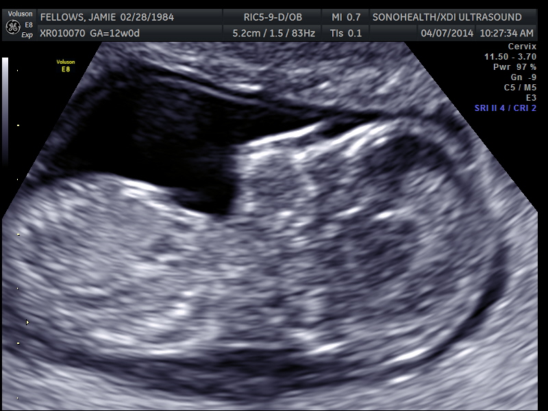Name:  My baby sono_11.jpg
Views: 2075
Size:  183.9 KB