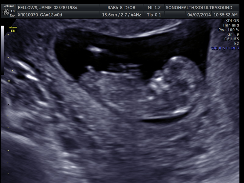 Name:  My baby sono_19.jpg
Views: 7254
Size:  153.6 KB