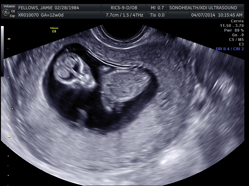 Name:  My baby sono_4.jpg
Views: 2577
Size:  204.4 KB