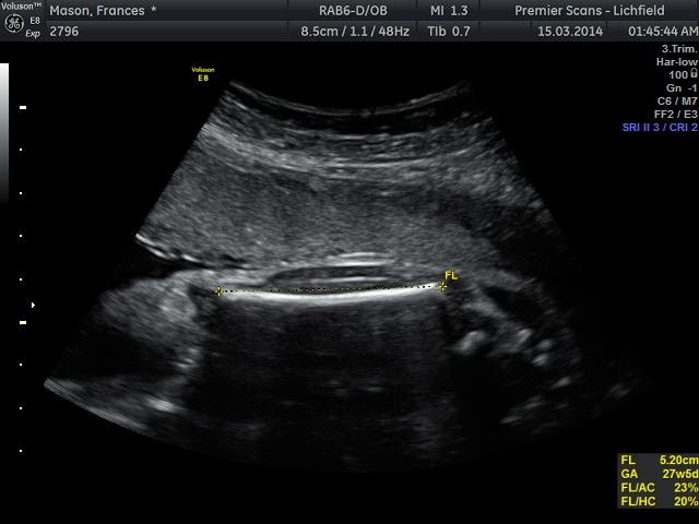 Name:  frances mason_34.jpg
Views: 72
Size:  91.0 KB
