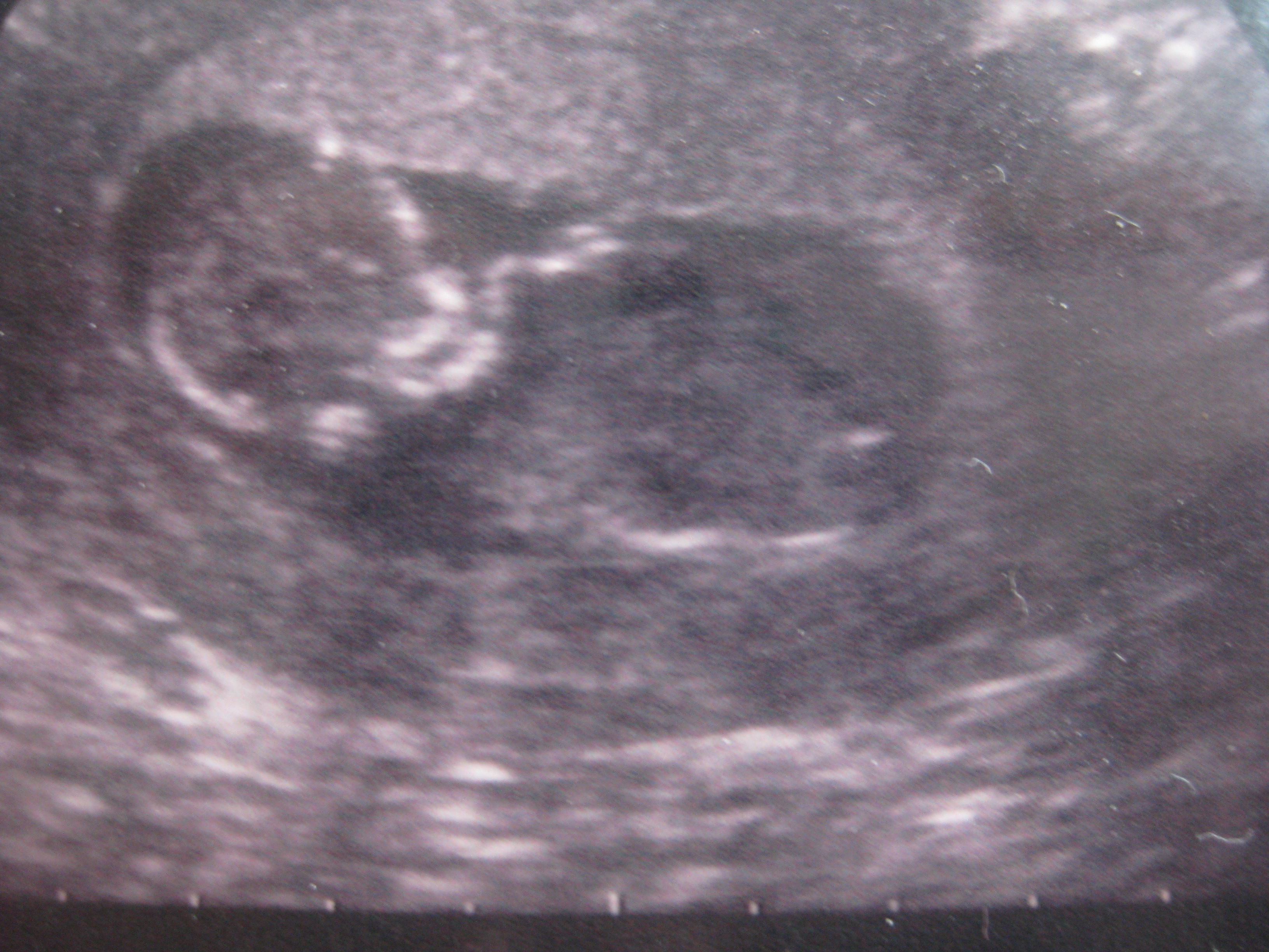 Name:  Baby Scan.JPG
Views: 166
Size:  1.87 MB