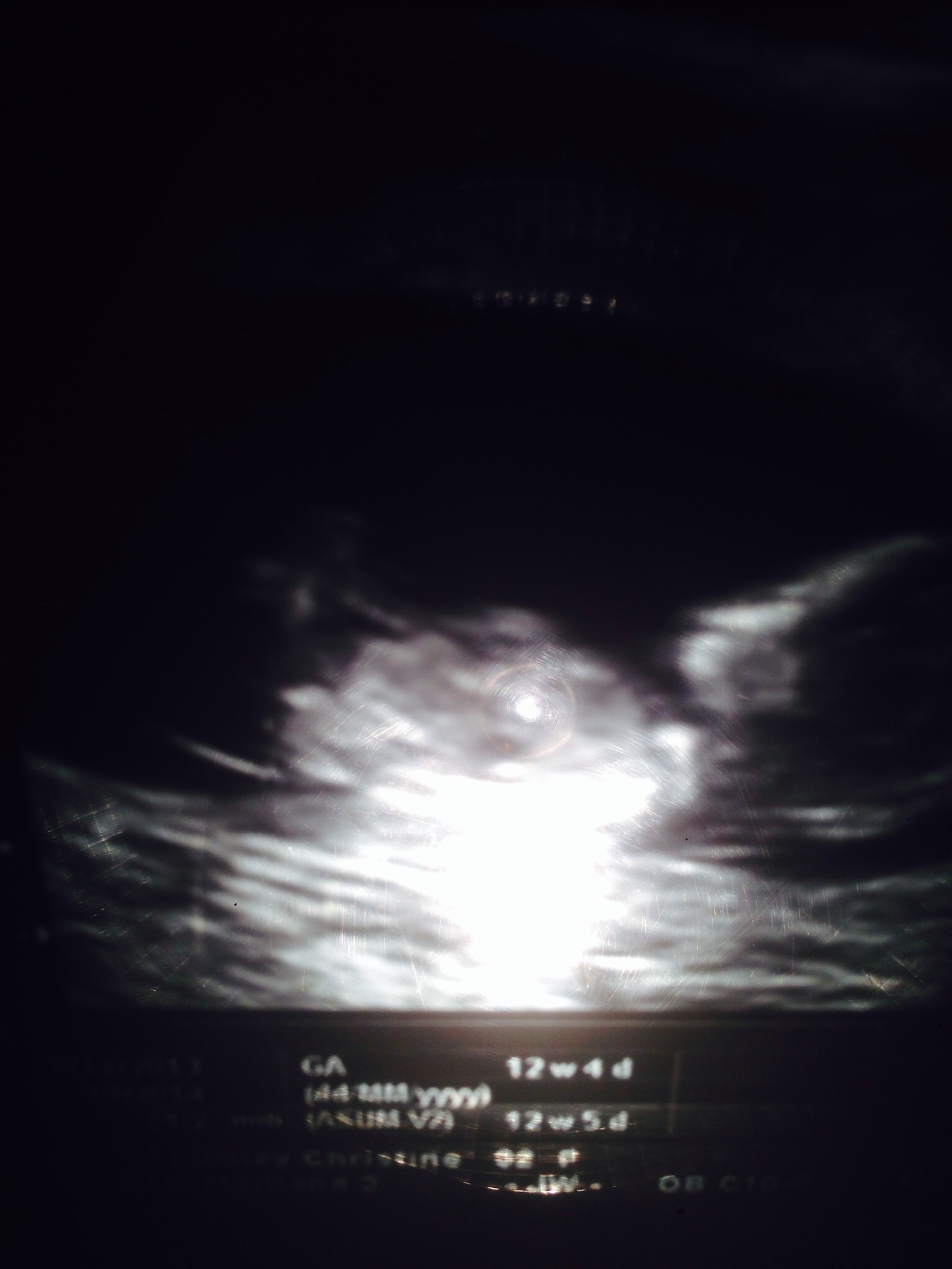 Name:  image.jpg
Views: 139
Size:  363.1 KB
