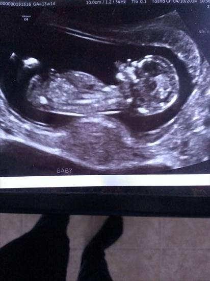 Name:  ultrasound1.jpg
Views: 273
Size:  29.0 KB