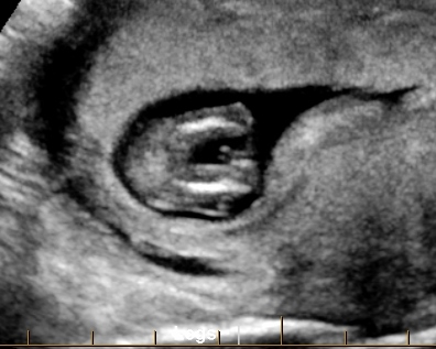 Name:  baby3 0001.jpg
Views: 140
Size:  85.0 KB