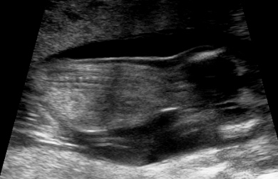 Name:  baby5 0001.jpg
Views: 105
Size:  69.1 KB