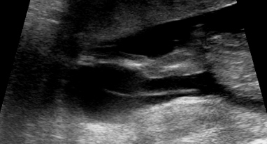 Name:  baby6 0001.jpg
Views: 100
Size:  60.4 KB