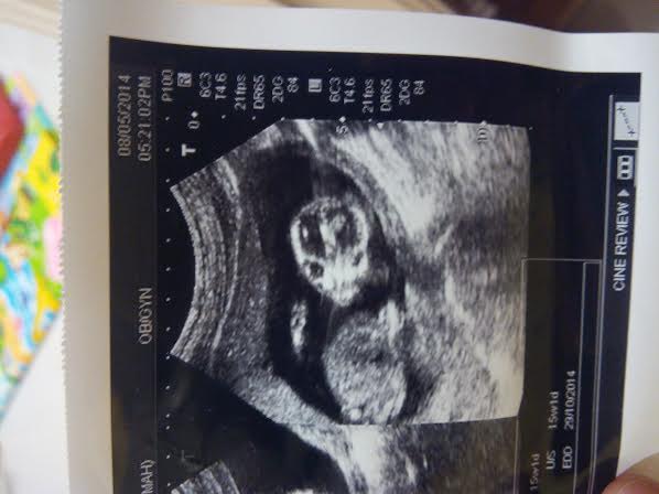 Name:  15 week.jpg
Views: 262
Size:  29.1 KB
