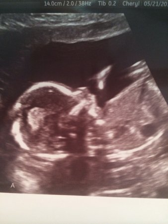 Name:  PROFILE SHOT2.jpg
Views: 134
Size:  22.7 KB
