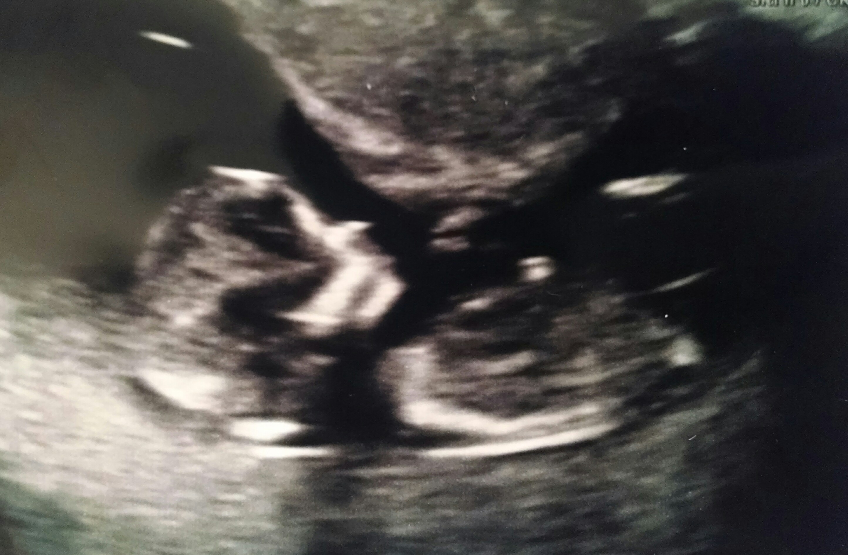 Name:  baby_01.jpg
Views: 527
Size:  719.1 KB