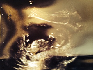 Name:  Baby 2 1.jpg
Views: 103
Size:  32.1 KB