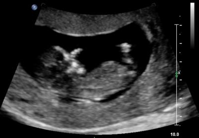Name:  peanut2.jpg
Views: 237
Size:  13.9 KB