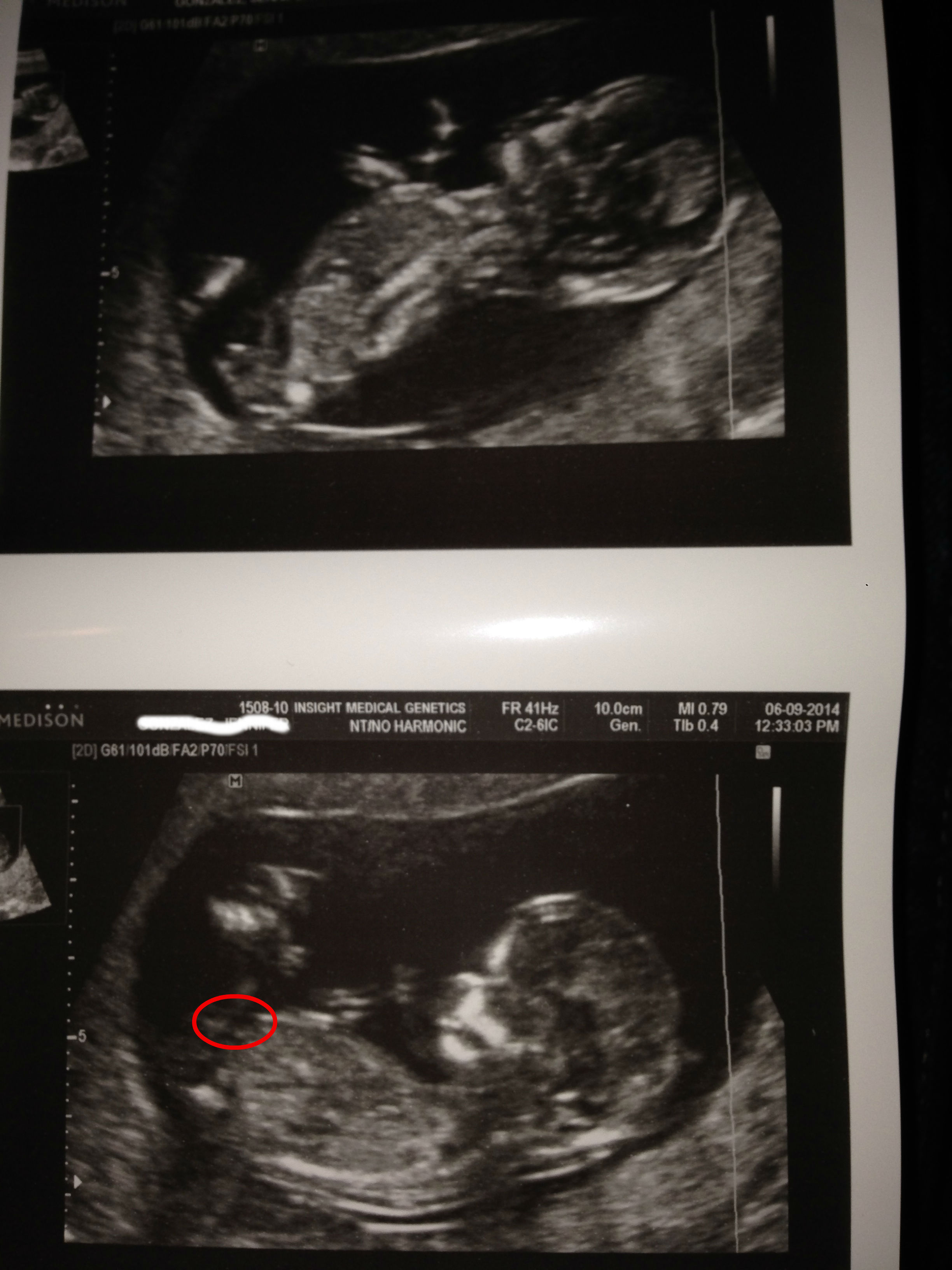 Name:  baby2.jpg
Views: 461
Size:  574.0 KB