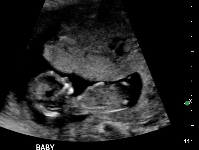 Name:  baby#2.jpg
Views: 252
Size:  52.1 KB