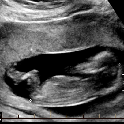 Name:  baby 0002.jpg
Views: 161
Size:  99.8 KB