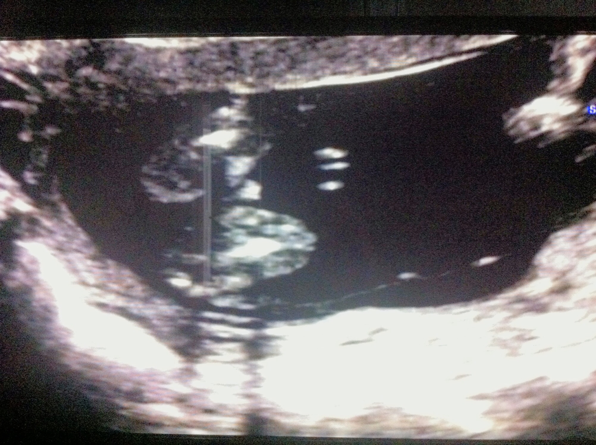 Name:  image.jpg
Views: 221
Size:  881.5 KB