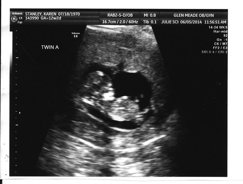 Name:  baby_stanley_12wks-A.jpg
Views: 260
Size:  74.4 KB