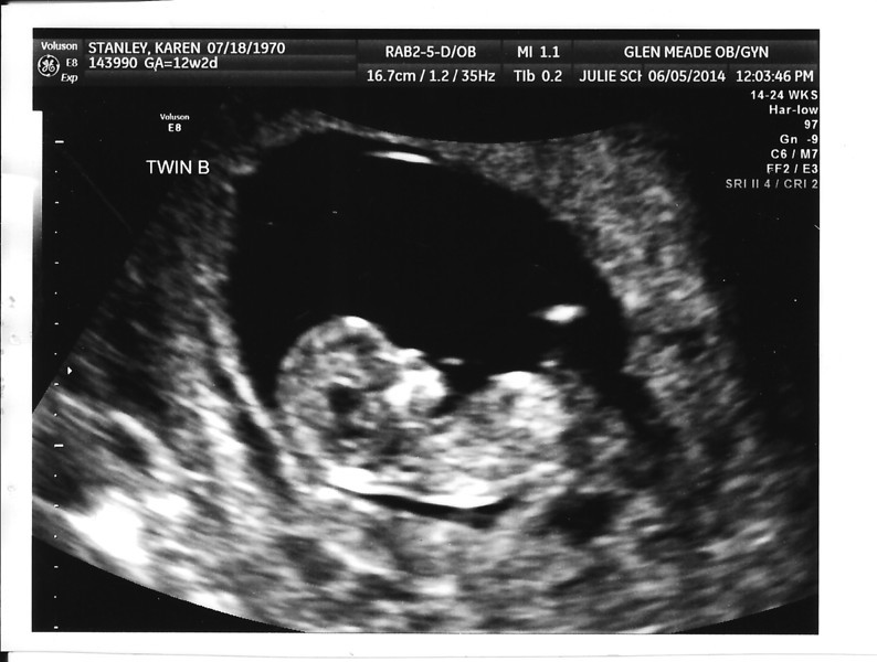 Name:  baby_stanley_12wks-B.jpg
Views: 243
Size:  80.5 KB