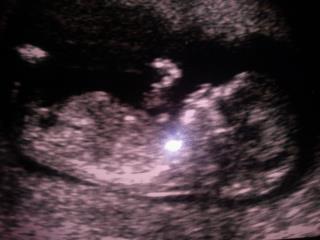 Name:  12 w 5 days.jpg
Views: 71
Size:  11.6 KB