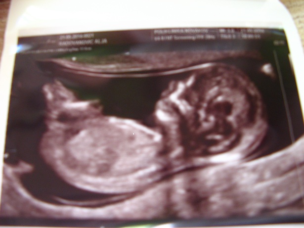 Name:  IMG_0137.JPG
Views: 296
Size:  91.6 KB