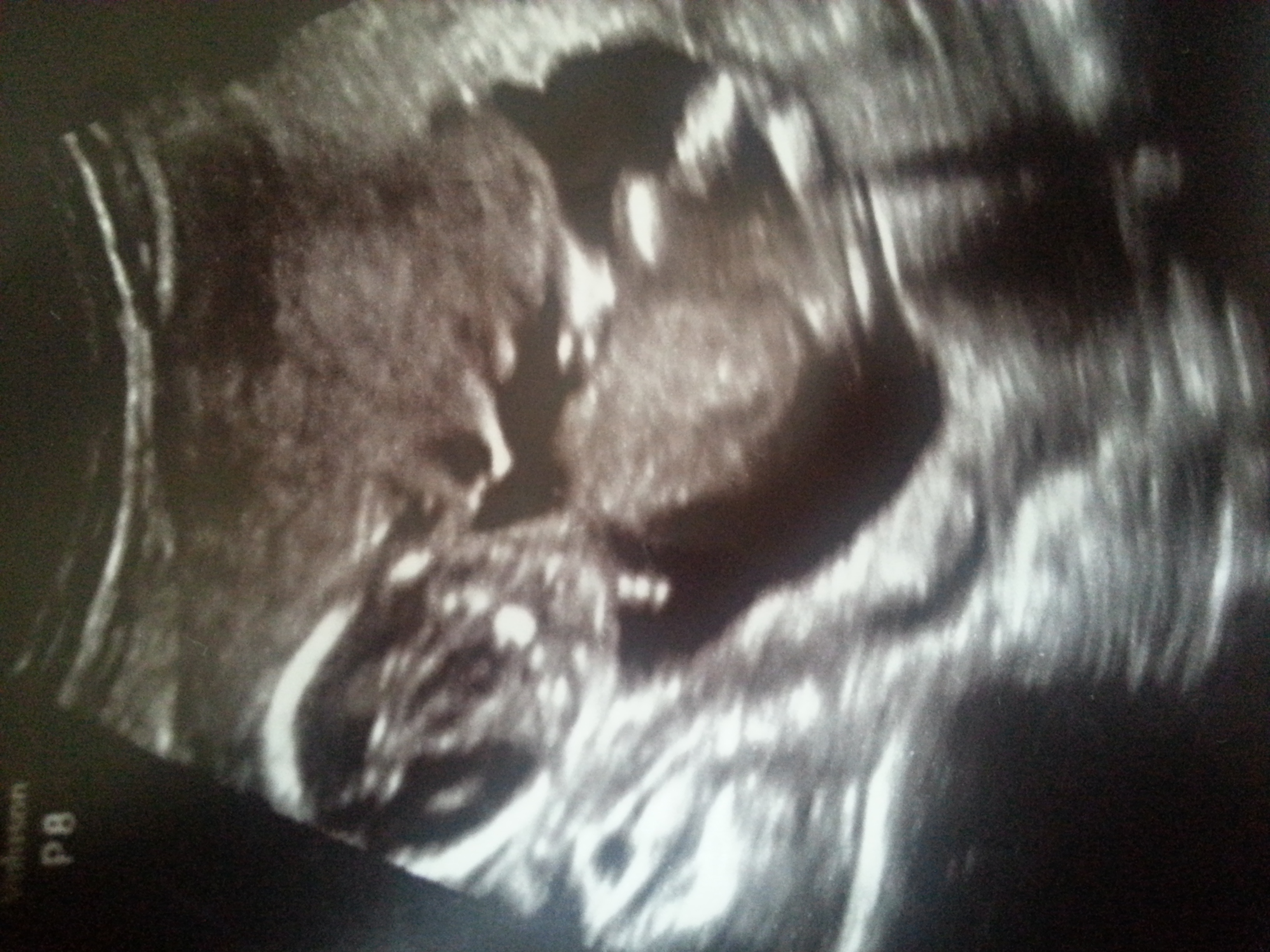 Name:  20140630_144708.jpg
Views: 341
Size:  1.97 MB