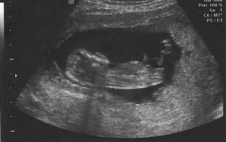 Name:  Scan 1 baby 4.jpg
Views: 238
Size:  39.4 KB