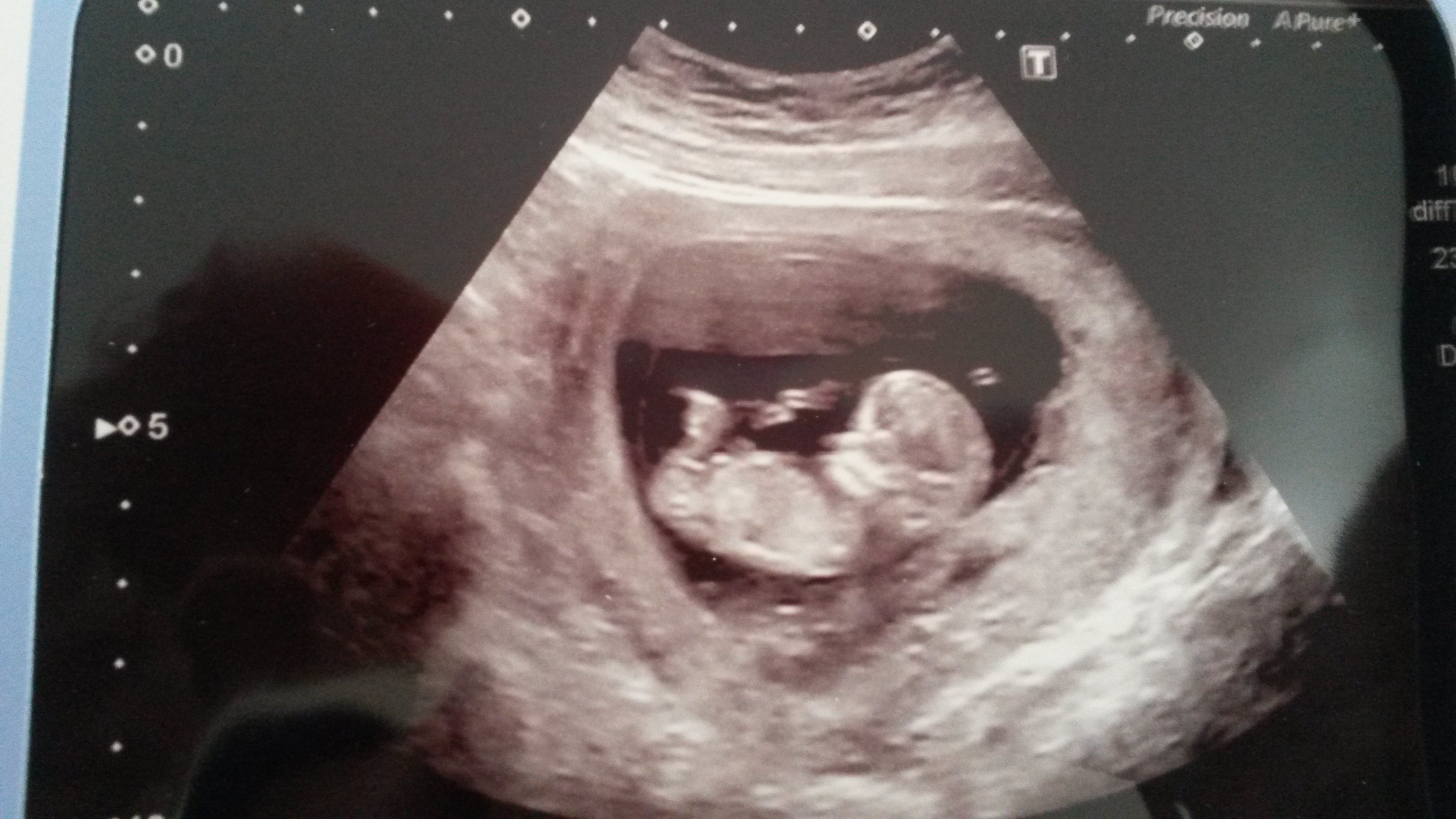 Name:  baby.jpg
Views: 4440
Size:  1.71 MB