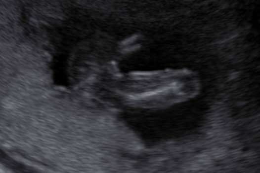 Name:  BABY_0010.jpg
Views: 77
Size:  30.9 KB