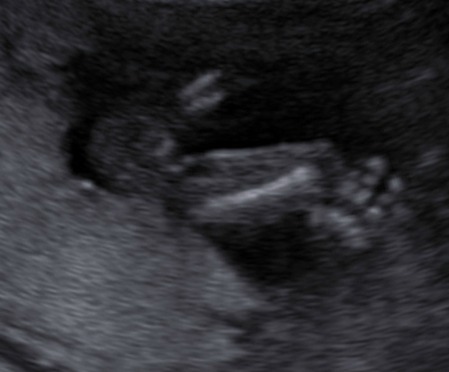 Name:  BABY_0011.jpg
Views: 76
Size:  28.8 KB
