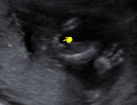 Name:  BABY_0012.jpg
Views: 69
Size:  27.3 KB