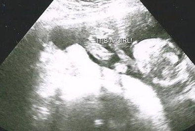 Name:  17 Weeks.jpg
Views: 204
Size:  36.1 KB