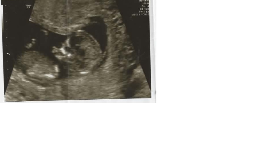 Name:  us3.jpg
Views: 153
Size:  50.9 KB