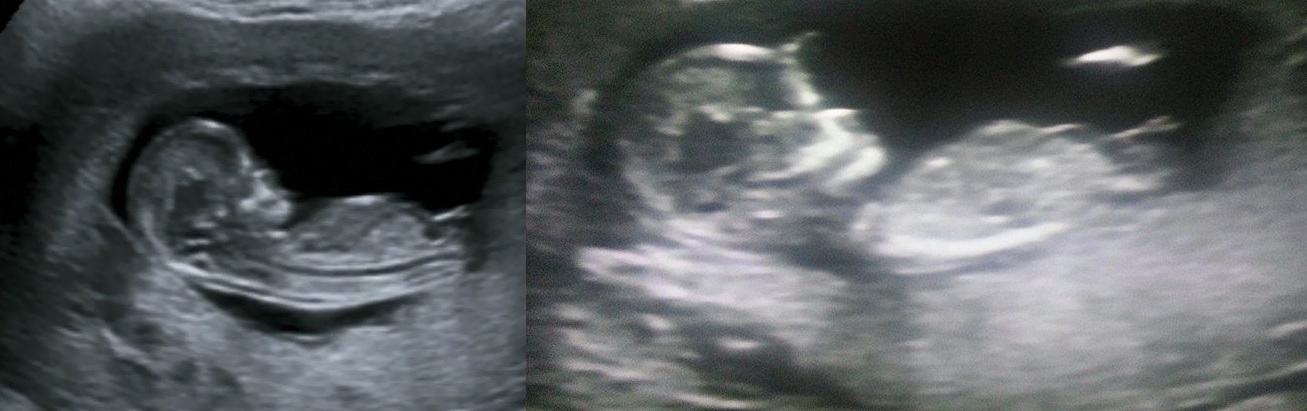 Name:  baby33333.jpg
Views: 149
Size:  134.2 KB
