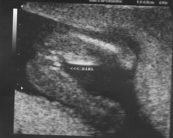 Name:  16w gender #4.jpg
Views: 137
Size:  32.3 KB
