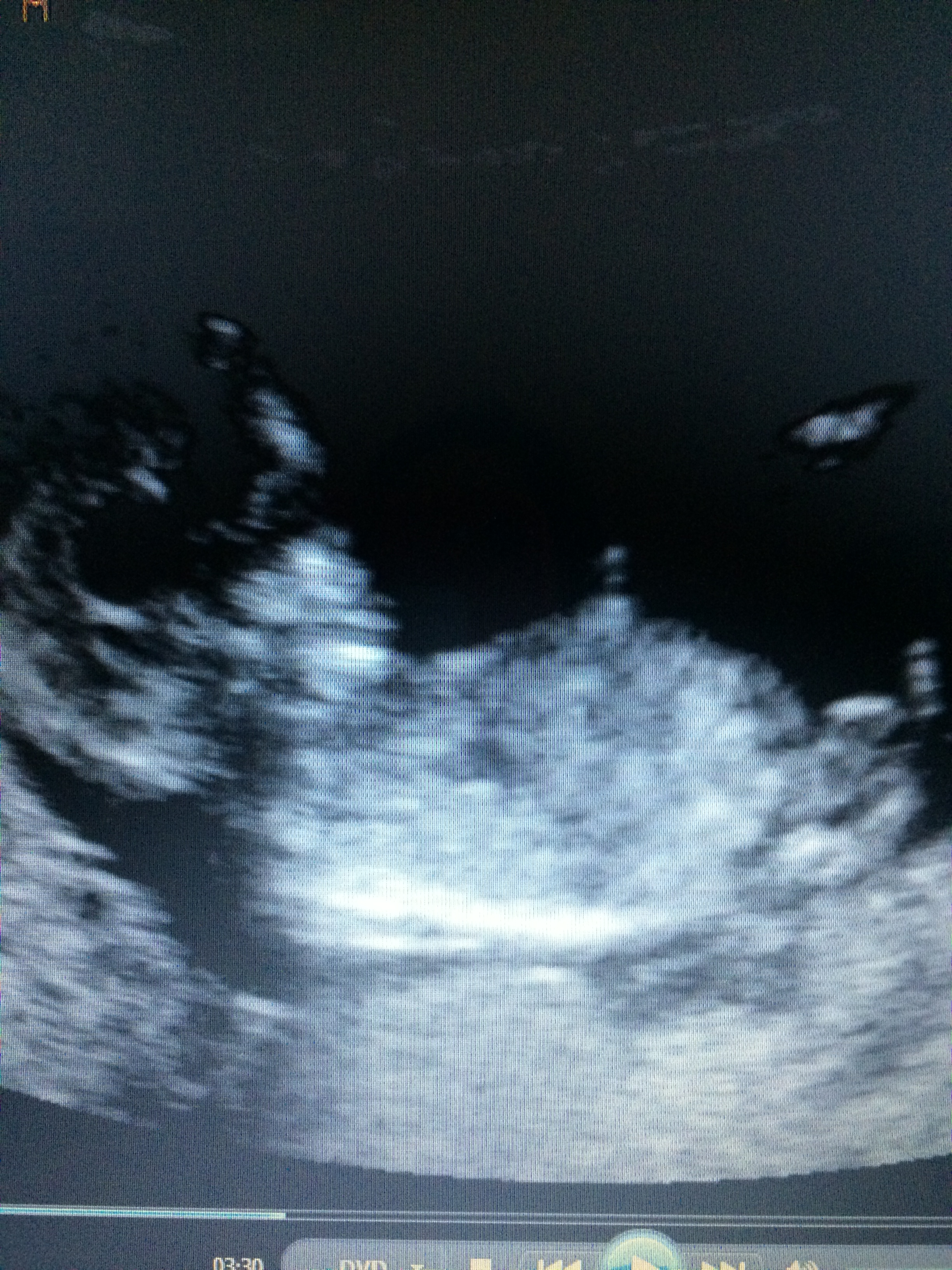 Name:  BABY SONO 002.JPG
Views: 501
Size:  3.22 MB