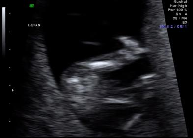 Name:  Screen shot 2014-08-03 at 9.05.41 PM.jpg
Views: 114
Size:  11.6 KB