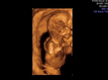 Name:  Screen shot 2014-08-05 at 10.09.19 PM.jpg
Views: 149
Size:  8.1 KB