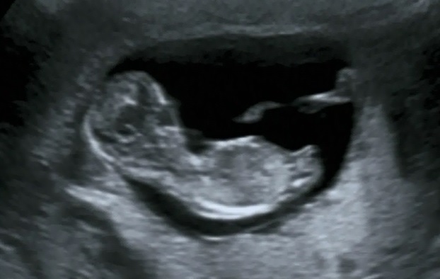 Name:  baby2.jpg
Views: 439
Size:  47.0 KB