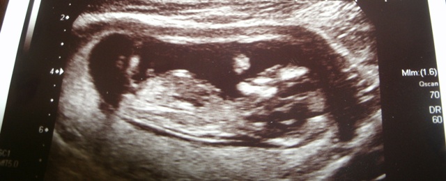 Name:  baby3.jpg
Views: 148
Size:  108.5 KB