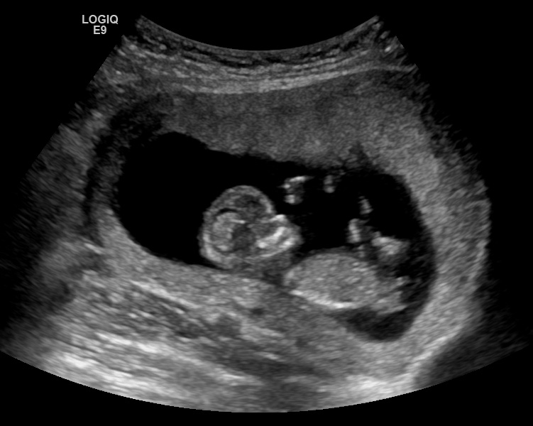 Name:  Image09.jpg
Views: 215
Size:  109.0 KB