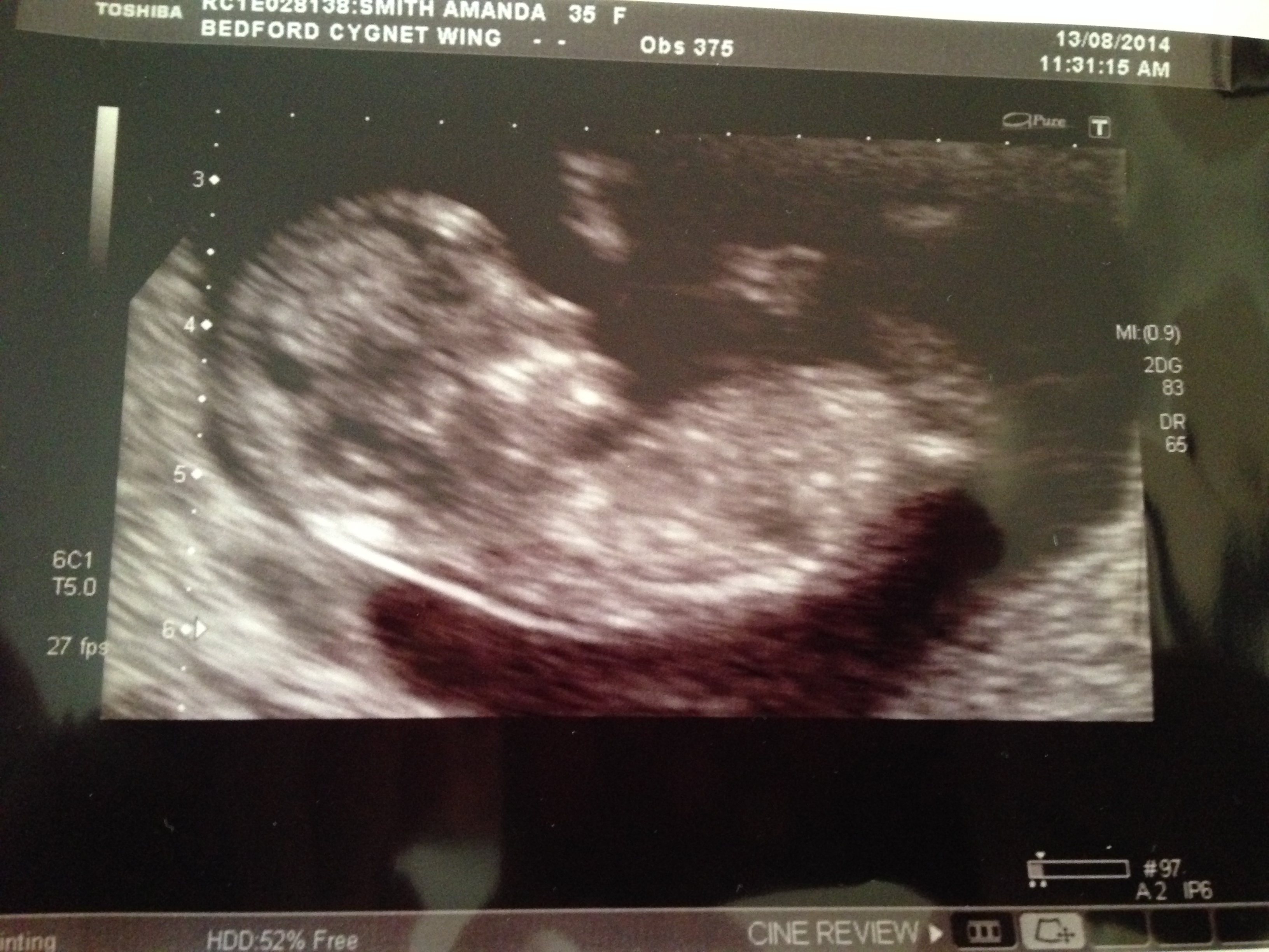 Name:  baby..jpg
Views: 82
Size:  1.86 MB