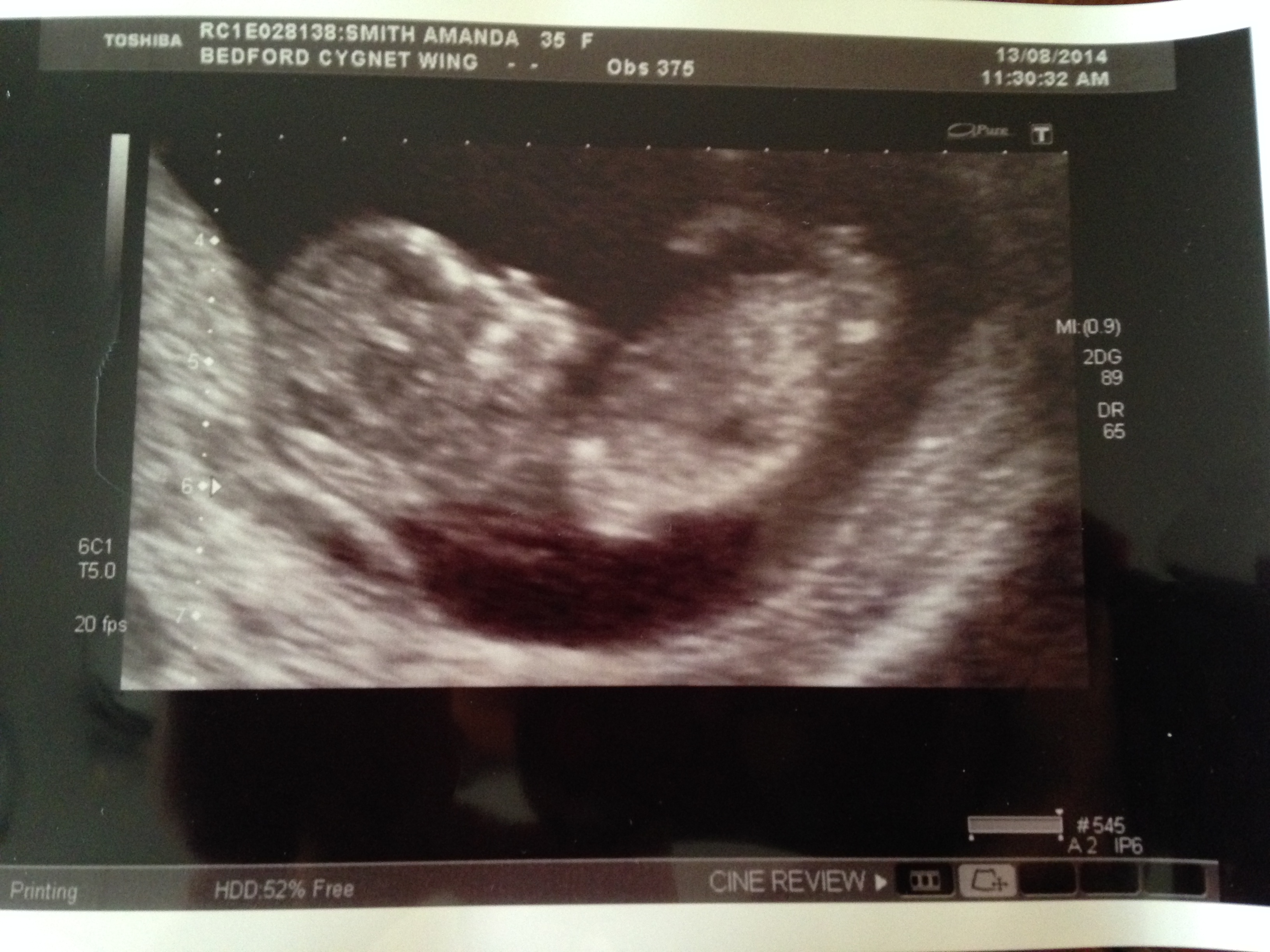Name:  baby.jpg
Views: 114
Size:  1.83 MB